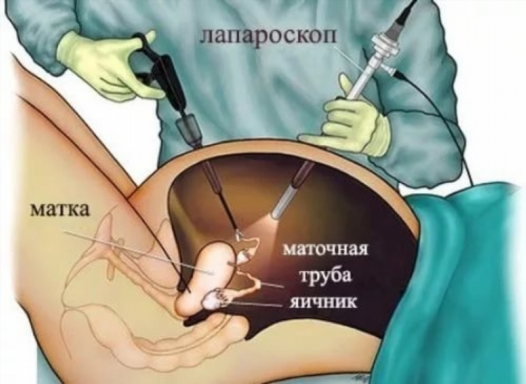 Впн орбот